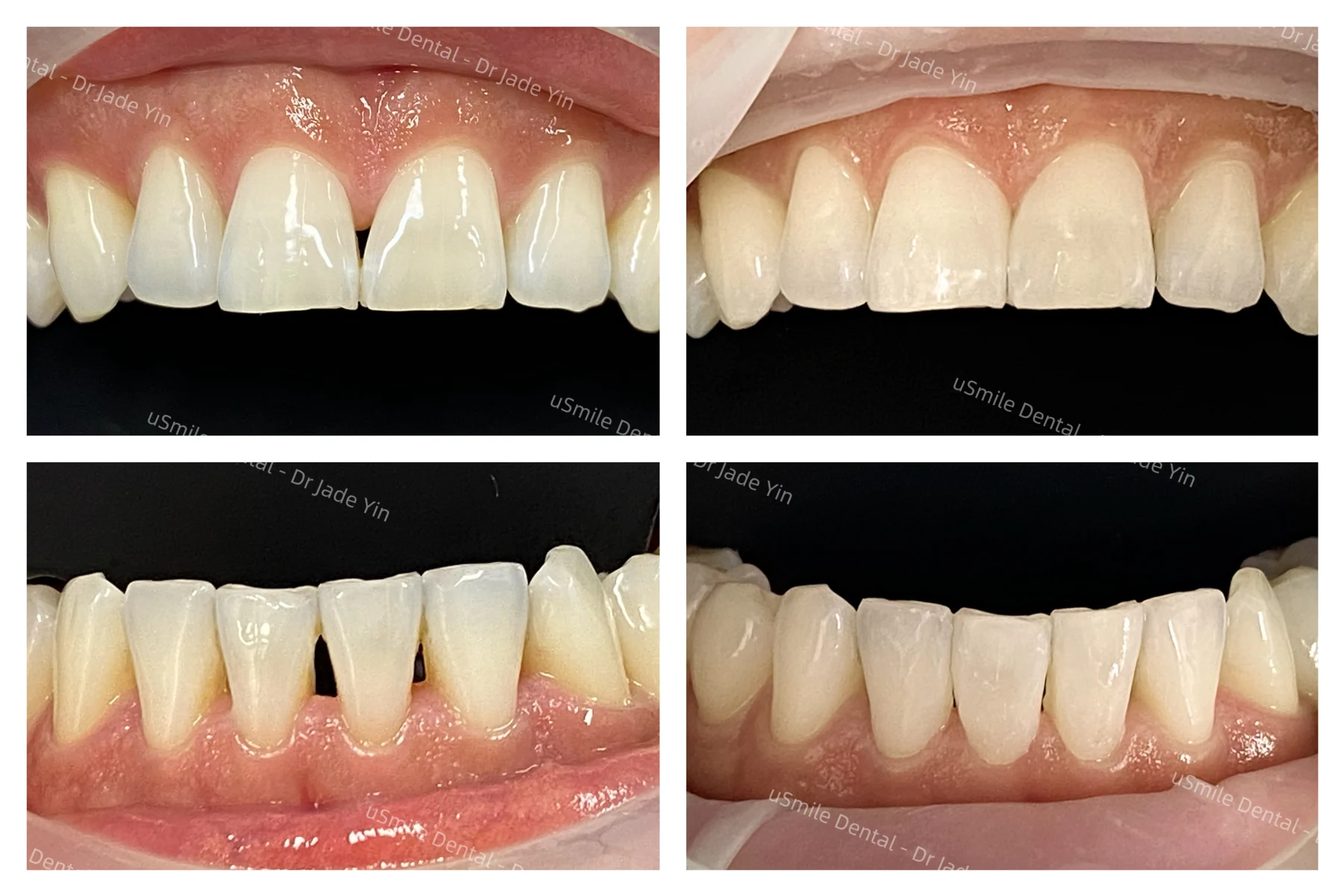 Other cases · case 07 — supplied clinical comparison