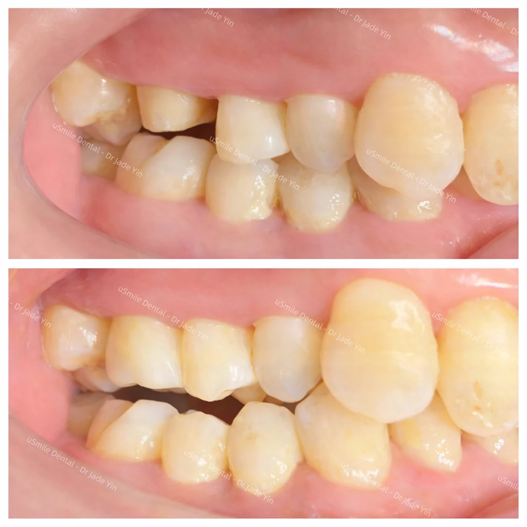 Crowns & veneers · case 09 — supplied clinical comparison