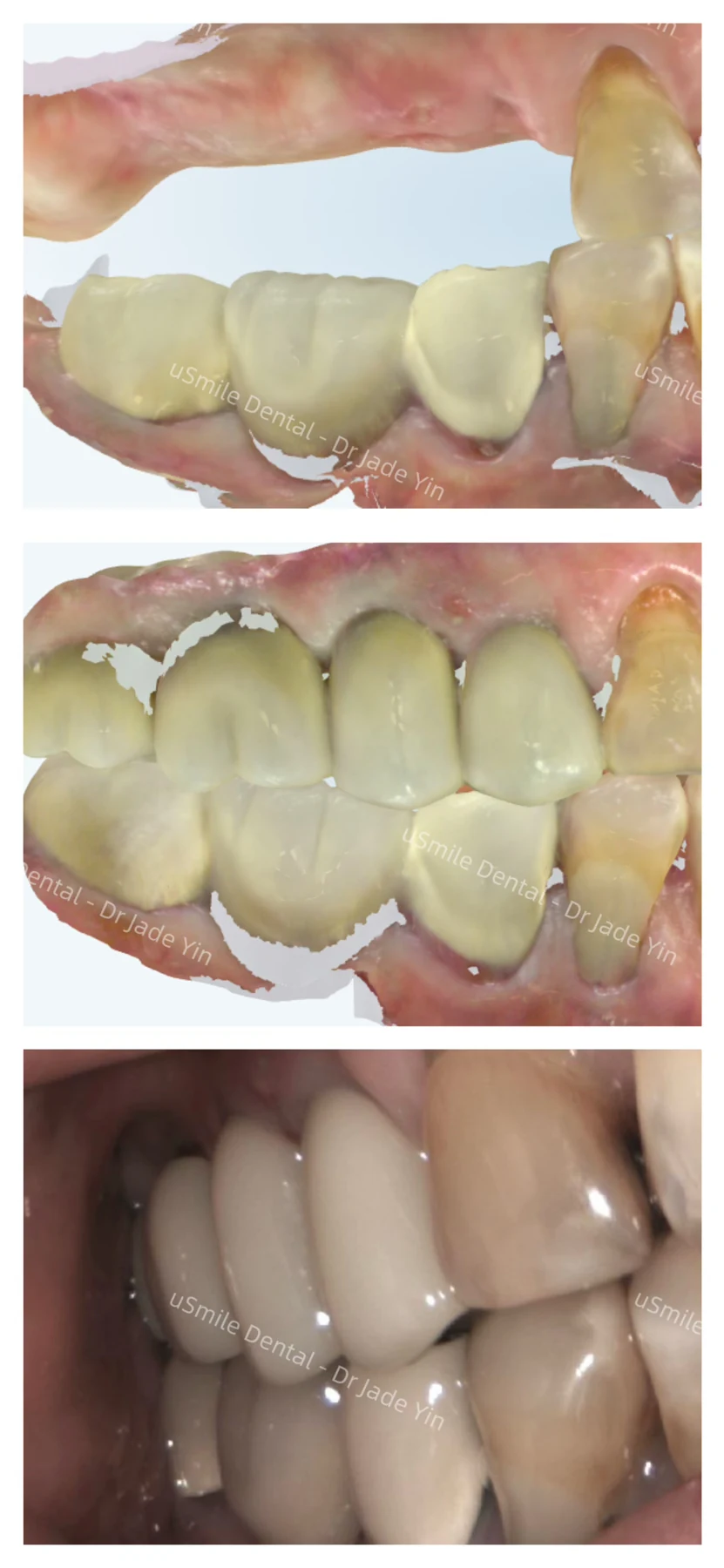 Implants · case 25 — supplied clinical comparison