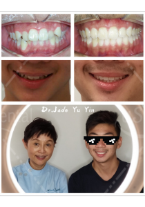 Original uSmile Dental smile gallery image 16, shown in full