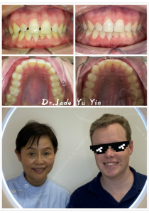 Original uSmile Dental smile gallery image 18, shown in full