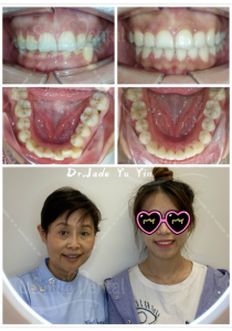 Original uSmile Dental smile gallery image 19, shown in full