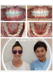 Original uSmile Dental smile gallery image 1, shown in full