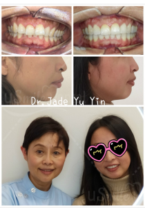 Original uSmile Dental smile gallery image 2, shown in full