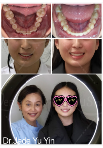 Original uSmile Dental smile gallery image 8, shown in full
