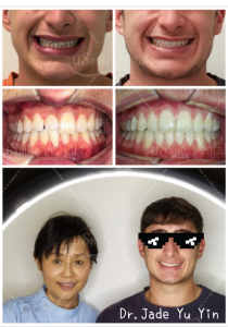 Original uSmile Dental smile gallery image 4, shown in full