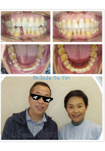 Original uSmile Dental smile gallery image 6, shown in full