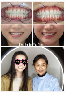 Original uSmile Dental smile gallery image 7, shown in full