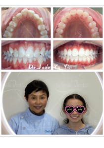 Original uSmile Dental smile gallery image 9, shown in full