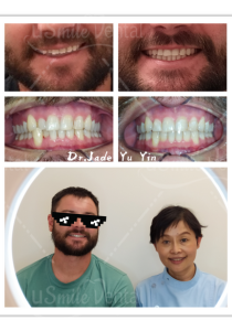 Original uSmile Dental smile gallery image 11, shown in full