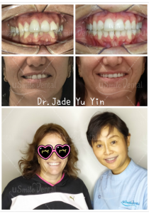 Original uSmile Dental smile gallery image 13, shown in full