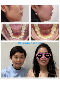 Original uSmile Dental smile gallery image 15, shown in full