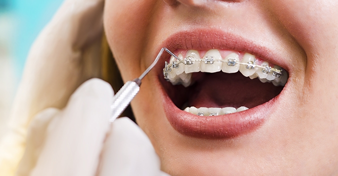 Orthodonticimg1