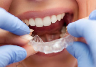 Doctor Or Orthodontist Who Is The Right Invisalign Provider
