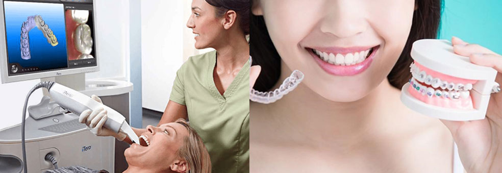 How Is Your Invisalign Treatment Plan Made